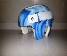 arturo-eyries-ortopedia-casco-02.jpg
