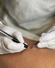 Katja Steinle - Less hair & care - dauerhafte Haarentfernung Bild 5