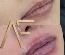 Dr Alexis Fernandez | Medicina Estetica imagen 1