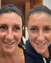 Juvenalia Brío | Botox, Hydrafacial & Ultraformer - Condesa / Roma Norte CDMX imagen 8