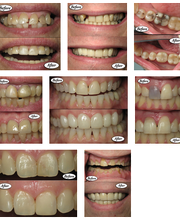 Waltzer Berry Dental Associates of Cherry Hill image 17
