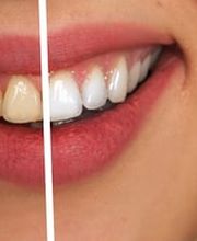 Cabinet Dentaire Dresse Pascale Cloastre SSO - SVMD Bild 2