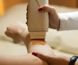 Das Bild zeigt eine Kosmetikerin, die einen Epilierer verwendet, um feine Haare auf dem Unterarm einer Kundin zu entfernen. Der Arm liegt stabil, während das Gerät präzise über die Haut geführt wird. Die Szene wirkt professionell, hygienisch und zeigt eine gängige Methode der Haarentfernung im kosmetischen Bereich. Der Fokus liegt auf dem Epiliergerät und der sorgfältigen Anwendung durch die Fachkraft.