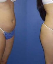 Gotham Plastic Surgery image 1