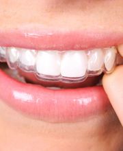 Isabel Perales Clínica Dental imagen 4