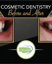 Northeast Lincoln Family Dentistry image 10