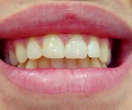 Clínica Dental Quart imagen 6