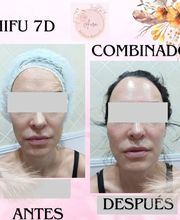1cfd1db1-1fe6-48dc-9653-ed7a05bfffe7.jpg