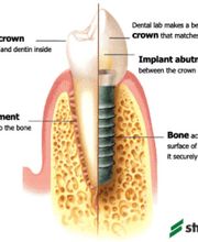 Signature Smiles of Park Ridge image 5