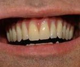 Clínica Implanteoral Milladoiro imagen 16