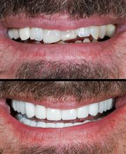 Flawless Smile Dentistry Claremore image 11