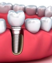 Zahnmedizin Rupperswil Bild 4