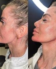 Grace Medspa & Body Solutions image 5