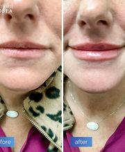 dermani MEDSPA Roswell image 1