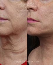 Gotham Plastic Surgery image 7