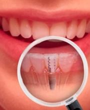 Studio Dentistico Dr. Coler SA Bild 6