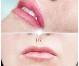 Néoly Beauty image 13