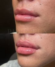 Pure Lux Medspa image 8