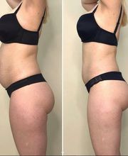 Centre d'Amincissement et de Sport image 9