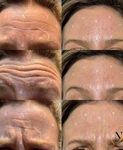 PureBeautyNP Aesthetics image 2