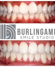 Burlingame Smile Studio Orthodontist April Lee DDS MS image 3