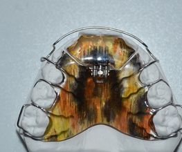 Dental Design ILG Bild 2