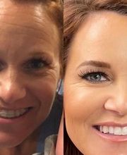 Schweiger Dermatology Group - Glen Carbon image 13