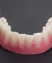 Daniel Wirz Zahnprothetik Bild 6