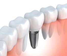 Clínica Dental Quart imagen 19