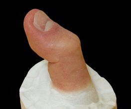 Kornelius Egner Epithetik Bild 4