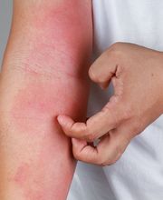 Radiant Dermatology & Aesthetics - Cleveland image 4