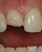 TERAN Dental Co. image 18