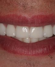 Metro Smiles P.C. image 11