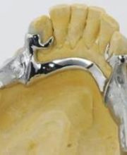 Dentallabor Christian Stroehl Bild 3