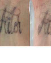 ADIÓS TATTOOS VALENCIA imagen 12