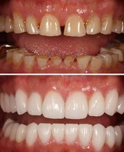 Aesthetic Dentistry, P.C. image 2