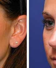 Synergy MedAesthetics image 19