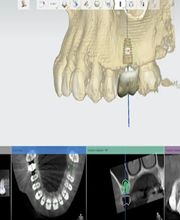 NYC Periodontics and Implant Dentistry: Scott O. Kissel, DMD, PC image 18