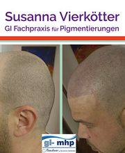 Haarpigmentierung Gi mhp -