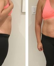 UniQ Laser Center Watertown image 19