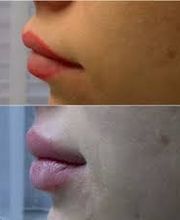 dr. med. Prandelli Emiliano Bild 4