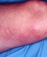 Consulta Barreiro-Vascular (Drs. A. Barreiro Mouro y J. Barreiro Veiguela) imagen 2