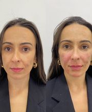 Estética Raphaela Santana imagen 12