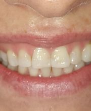 Clínica Dental Dres. Nuñez García imagen 2