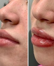 dermani MEDSPA Roswell image 8
