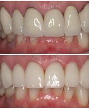 Metro Smiles P.C. image 15