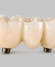 CeraLab - Das digitale Dentallabor Bild 6