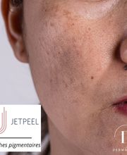 Dermopeel image 8