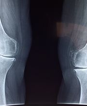 Orthopäde Dr. Michael Prange Bild 2