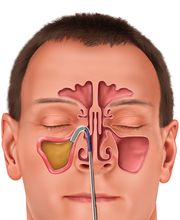 Freedman ENT Downriver image 15